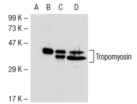 Tropomyosin (FL-284): sc-28543. Western blot analysis of Tropomyosin expression in non-transfected 293T: sc-117752 (A), mouse Tropomyosin transfected 293T: sc-126153 (B), CCD-1064Sh (C) and Sol8 (D) whole cell lysates.