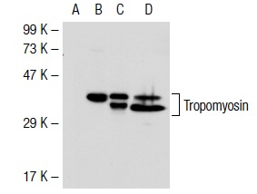 Tropomyosin (FL-284): sc-28543. Western blot analysis of Tropomyosin expression in non-transfected 293T: sc-117752 (A), mouse Tropomyosin transfected 293T: sc-126154 (B), CCD-1064Sh (C) and Sol8 (D) whole cell lysates.