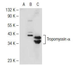 Tropomyosin (FL-284): sc-28543. Western blot analysis of Tropomyosin α expression in non-transfected 293T: sc-117752 (A), human Tropomyosin α transfected 293T: sc-159958 (B) and CCD-1064Sk (C) whole cell lysates.