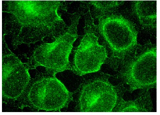 Tropomyosin (FL-284): sc-28543. Immunofluorescence staining of methanol-fixed HeLa cells showing cytoplasmic and cytoskeletal localization.