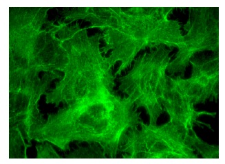 Tropomyosin (FL-284): sc-28543. Immunofluorescence staining of formalin-fixed Hep G2 cells showing cytoskeletal localization.
