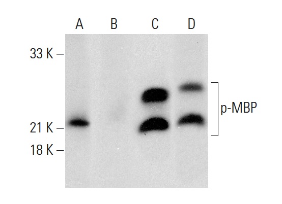 Western blot analysis of MBP phosphorylation in untreated (A,C) and lambda protein phosphatase (sc-200312A) treated (B,D) rat brain tissue extract. Antibodies tested include p-MBP (D-11): sc-365621 (A,B) and MBP (BM15): sc-52070 (C,D).