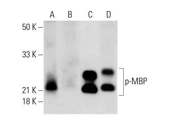 Western blot analysis of MBP phosphorylation in untreated (A,C) and lambda protein phosphatase (sc-200312A) treated (B,D) rat cerebellum tissue extract. Antibodies tested include p-MBP (D-11): sc-365621 (A,B) and MBP (BM15): sc-52070 (C,D).