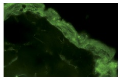 UKHC (H-50): sc-28538. Immunofluorescence staining of normal mouse skin frozen section showing cytoplasmic staining in epithelial cells.
