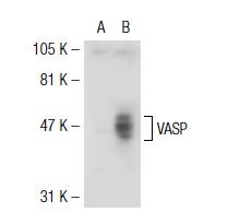 VASP (S-19): sc-1950. Western blot analysis of VASP expression in non-transfected: sc-117752 (A) and human VASP transfected: sc-114829 (B) 293T whole cell lysates.