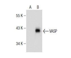 VASP (S-19): sc-1950. Western blot analysis of VASP expression in non-transfected: sc-117752 (A) and mouse VASP transfected: sc-127758 (B) 293T whole cell lysates.