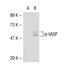 p-VASP (Ser 239): sc-23507. Western blot analysis of VASP phosphorylation in non-transfected: sc-117752 (A) and mouse VASP transfected: sc-127758 (B) 293T whole cell lysates.