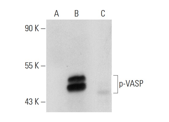 p-VASP (Ser 239): sc-23507. Western blot analysis of VASP phosphorylation in untreated non-transfected: sc-117752 (A), untreated human VASP transfected: sc-114829 (B) and lambda protein phosphatase treated human VASP transfected: sc-114829 (C) 293T whole cell lysates.