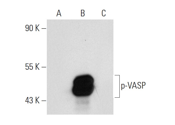 p-VASP (Ser 239)-R: sc-23507-R. Western blot analysis of VASP phosphorylation in untreated non-transfected: sc-117752 (A), untreated human VASP transfected: sc-114829 (B) and lambda protein phosphatase treated human VASP transfected: sc-114829 (C) 293T whole cell lysates.
