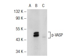 p-VASP (Ser 239): sc-23507. Western blot analysis of VASP phosphorylation in non-transfected: sc-117752 (A), untreated human VASP transfected: sc-114829 (B) and lambda protein phosphatase treated human VASP transfected: sc-114829 (C) 293T whole cell lysates.