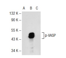 p-VASP (Ser 239)-R: sc-23507-R. Western blot analysis of VASP phosphorylation in non-transfected: sc-117752 (A), untreated human VASP transfected: sc-114829 (B) and lambda protein phosphatase treated human VASP transfected: sc-114829 (C) 293T whole cell lysates.
