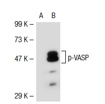 p-VASP (16C2): sc-101439. Western blot analysis of VASP phosphorylation in non-transfected: sc-117752 (A) and mouse VASP transfected: sc-127758 (B) 293T whole cell lysates.