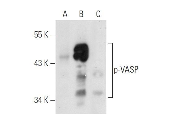 p-VASP (16C2): sc-101439. Western blot analysis of VASP phosphorylation in untreated non-transfected: sc-117752 (A), untreated human VASP transfected: sc-114829 (B) and lambda protein phosphatase treated human VASP transfected: sc-114829 (C) 293T whole cell lysates.