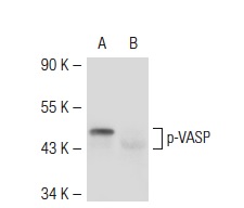p-VASP (16C2): sc-101439. Western blot analysis of VASP phosphorylation in untreated (A) and lambda protein phosphatase treated (B) human platelet extracts.