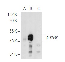 p-VASP (16C2): sc-101439. Western blot analysis of VASP phosphorylation in non-transfected: sc-117752 (A), untreated human VASP transfected: sc-114829 (B) and lambda protein phosphatase treated human VASP transfected: sc-114829 (C) 293T whole cell lysates.