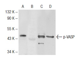 Western blot analysis of VASP phosphorylation in untreated (A, C), and lambda protein phosphatase treated (B, D) human platelet extract. Antibodies tested include p-VASP (16C2): sc-101439 (A, B) and VASP (A-11): sc-46668 (C, D).