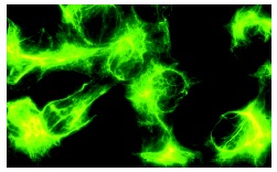Vimentin (RV202): sc-32322. Immunofluorescence staining of cultured bovine lens epithelial cells. Kindly provided by MUBio, Netherlands.