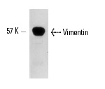 Vimentin (RV202): sc-32322. Western blot analysis of Vimentin expression in cytoskeletal preparation from bovine lens tissue. Kindly provided by MUBio, Netherlands.