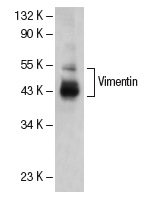 Vimentin (RV202): sc-32322. Western blot analysis of Vimentin and Vimentin degradation products expressed in HeLa whole cell lysate.