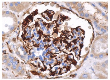 Vimentin (RV202): sc-32322. Immunoperoxidase staining of formalin fixed, paraffin-embedded human kidney tissue showing cytoskeletal staining of glomerular cells.