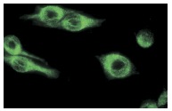 Vimentin (S-20): sc-7558. Immunofluorescence staining of methanol-fixed KNRK cells showing cytoskeletal localization.