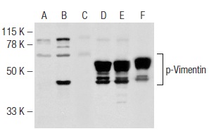 Western blot analysis of Vimentin phosphorylation in untreated (A,D), paclitaxel treated (B,E) and paclitaxel and lambda protein phosphatase (sc-200312A) treated (C,F) Jurkat whole cell lysates. Antibodies tested include p-Vimentin (Ser 83): sc-130610 (A,B,C) and Vimentin (V9): sc-6260 (D,E,F).