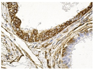 Vimentin (V9): sc-6260. Immunoperoxidase staining of formalin fixed, paraffin-embedded human testis tissue showing cytoskeletal staining of cells in epididymal ducts.