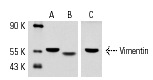 Western blot analysis of Vimentin expression in A-10 (A,C) and KNRK (B) whole cell lysates. Antibodies tested include Vimentin (V9): sc-6260 (A,B) and Vimentin (C-20): sc-7557 (C).