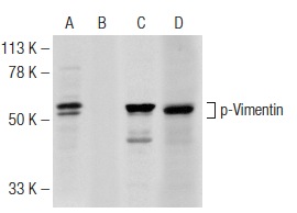 Western blot analysis of Vimentin phosphorylation in untreated (A,C) and lambda protein phosphatase (sc-200312A) treated (B,D) SJRH30 whole cell lysate. Antibodies tested include p-Vimentin (Ser 38)-R: sc-16673-R (A,B) and Vimentin (C-20)-R: sc-7557-R (C,D).