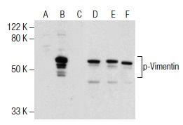 Western blot analysis of Vimentin phosphorylation in untreated (A,D), induction cocktail (sc-362324) treated (B,E) and induction cocktail (sc-362324) and lambda protein phosphatase (sc-200312A) treated (C,F) HeLa whole cell lysates. Antibodies tested include p-Vimentin (Ser 83): sc-130610 (A,B,C) and Vimentin (C-20)-R: sc-7557-R (D,E,F).
