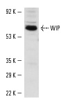 WIP (G-20): sc-16882. Western blot analysis of WIP expression in BJAB whole cell lysate.