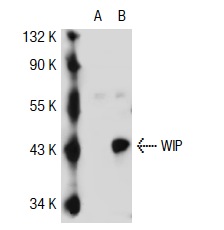 WIP (G-20): sc-16882. Western blot analysis of WIP expression in non-transfected: sc-117752 (A) and human WIP transfected: sc-111797 (B) 293T whole cell lysates.