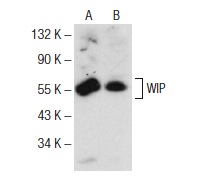 WIP (G-20): sc-16882. Western blot analysis of WIP expression in BJAB (A) and HL-60 (B) whole cell lysates.