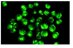 WIP (H-75): sc-25533. Immunofluorescence staining of methanol-fixed BJAB cells showing cytoskeletal localization.