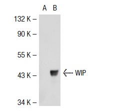 WIP (H-224): sc-25533. Western blot analysis of WIP expression in non-transfected: sc-117752 (A) and human WIP transfected: sc-111797 (B) 293T whole cell lysates.