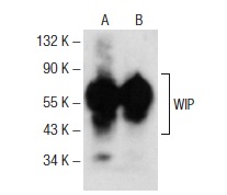 WIP (H-224): sc-25533. Western blot analysis of WIP expression in BJAB (A) and HL-60 (B) whole cell lysates.