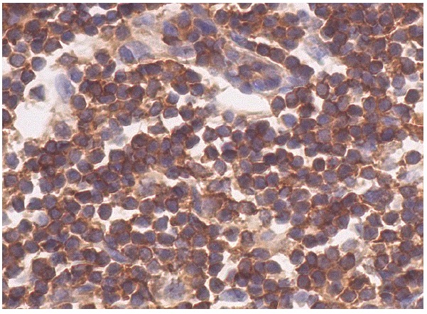 WIP (H-224): sc-25533. Immunoperoxidase staining of formalin fixed, paraffin-embedded human appendix tissue showing cytoplasmic staining of lymphoid cells.