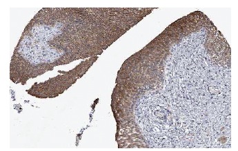 C21orf62 (T-14): sc-83562. Immunoperoxidase staining of formalin fixed, paraffin-embedded human Urinary bladder showing membrane staining of urothelial cells at low magnification. Kindly provided by The Swedish Human Protein Atlas (HPA) program.