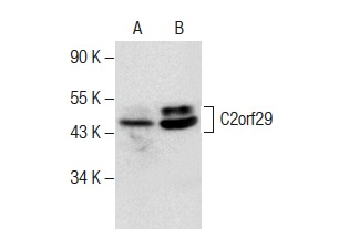 C2orf29 (C-6): sc-377068. Western blot analysis of C2orf29 expression in MCF7 (A) and TF-1 (B) whole cell lysates.