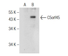 C5orf45 (Y-15): sc-241317. Western blot analysis of C5orf45 expression in non-transfected: sc-117752 (A) and human C5orf45 transfected: sc-370761 (B) 293T whole cell lysates.
