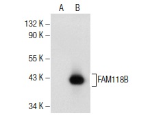 FAM118B (L-14): sc-241416. Western blot analysis of FAM118B expression in non-transfected: sc-117752 (A) and human FAM118B transfected: sc-371445 (B) 293T whole cell lysates.