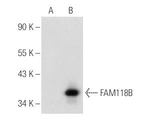 FAM118B (L-14): sc-241416. Western blot analysis of Ppp4r1l expression in non-transfected: sc-117752 (A) and mouse Ppp4r1l transfected: sc-118894 (B) 293T whole cell lysates.