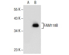 FAM118B (L-14): sc-241416. Western blot analysis of FAM118B expression in non-transfected: sc-117752 (A) and human FAM118B transfected: sc-110690 (B) 293T whole cell lysates.