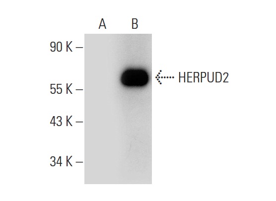 HERPUD2 (N-12): sc-164583. Western blot analysis of HERPUD2 expression in non-transfected: sc-117752 (A) and mouse HERPUD2 transfected: sc-120757 (B) 293T whole cell lysates.