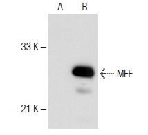 MFF (T-14): sc-168593. Western blot analysis of MFF expression in non-transfected: sc-117752 (A) and mouse MFF transfected: sc-121620 (B) 293T whole cell lysates.