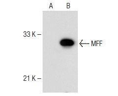 MFF (T-14): sc-168593. Western blot analysis of MFF expression in non-transfected: sc-117752 (A) and human MFF transfected: sc-110837 (B) 293T whole cell lysates.
