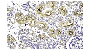 MIF4GD (F-22): sc-102025. Immunoperoxidase staining of formalin fixed, paraffin-embedded human kidney tissue showing cytoplasmic staining.