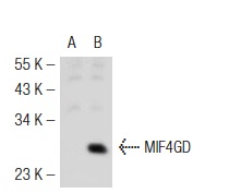 MIF4GD (F-22): sc-102025. Western blot analysis of MIF4GD expression in non-transfected: sc-117752 (A) and mouse MIF4GD transfected: sc-125617 (B) 293T whole cell lysates.