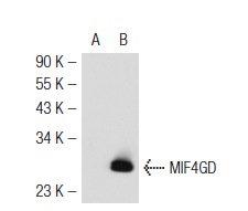 MIF4GD (F-22): sc-102025. Western blot analysis of MIF4GD expression in non-transfected: sc-117752 (A) and mouse MIF4GD transfected: sc-125616 (B) 293T whole cell lysates.