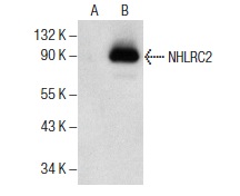 NHLRC2 (K-18): sc-240737. Western blot analysis of NHLRC2 expression in non-transfected: sc-117752 (A) and mouse NHLRC2 transfected: sc-122048 (B) 293T whole cell lysates.